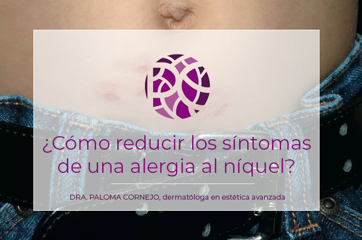 Escupir Pef Heredero Tienes alergia al níquel? Te cuento como reducir los síntomas – Paloma  Cornejo – Más que derma